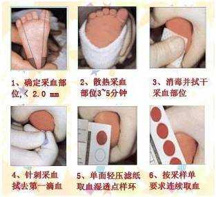  什么是足跟血「什么叫足跟血」