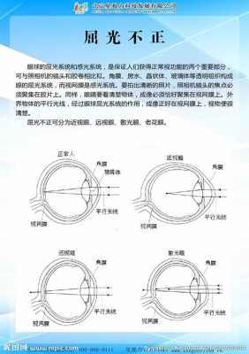 双眼屈光不正是什么意思（双眼屈光不正是什么意思 影响视功能）