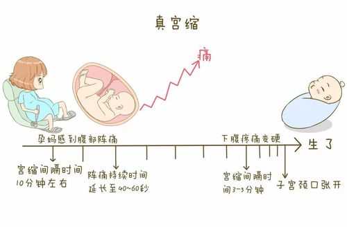 孕妇什么时候开始宫缩