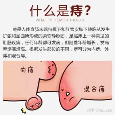 人为什么会有痔疮_人为什么会长痔疮的原因