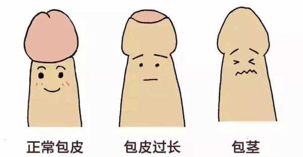 包皮是什么图片