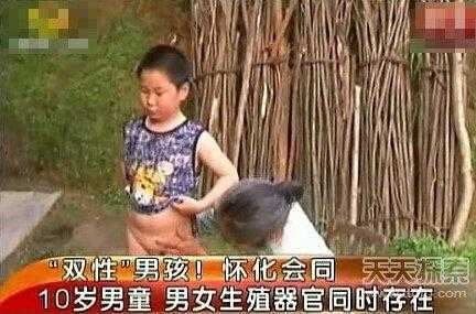 阴阳双体是图片 什么叫双性人