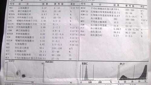 血常规可以查出什么病吗 血常规可以查出什么病