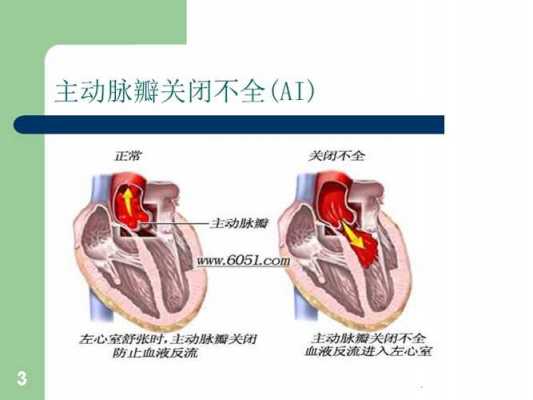 主动脉瓣轻度返流是什么意思（主动脉瓣轻度返流是怎么回事）