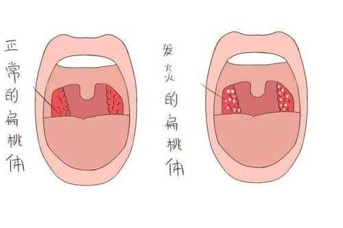  扁桃体是干什么用的「扁桃体是干什么用的,隔了可以吗」