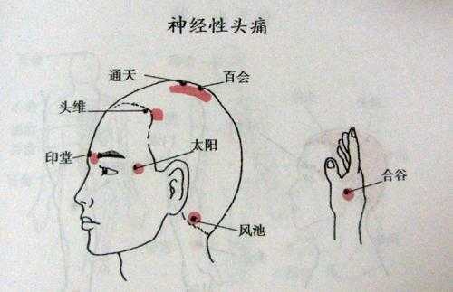  头老是疼是什么原因「头老是疼是什么原因?」