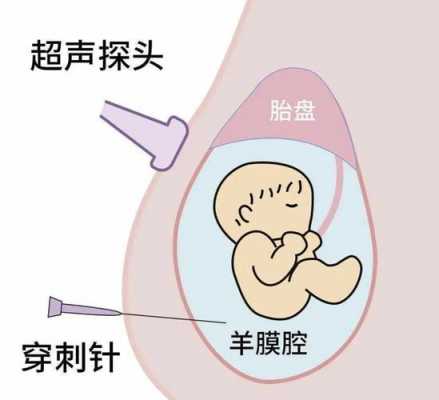 羊穿是什么,羊穿是什么时候开始有的 