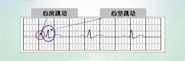 心跳慢什么原因（心电图心跳慢什么原因）