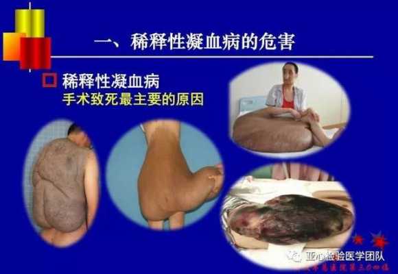 什么是凝血症_什么是凝血症状