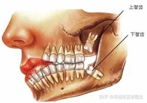 最后一个大牙叫什么齿 大牙叫什么齿