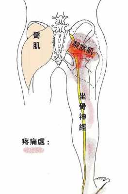 右背疼是什么原因引起（右背疼是什么原因引起的女人吃什么药）