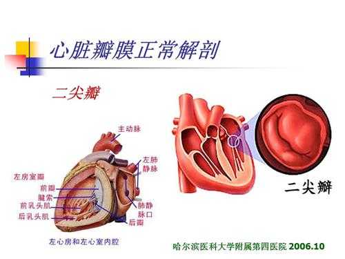 什么是心脏瓣膜病（什么是心脏瓣膜病?谢谢!）