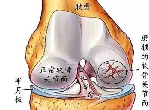 软骨是骨组织吗