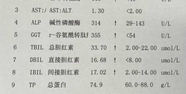  直接胆红素高是什么病「直接胆红素高是什么病引起的」