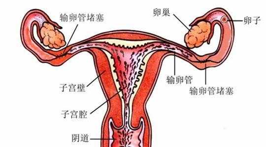  附件是什么部位「女性附件炎疼痛位置图」