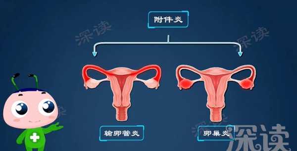  附件是什么部位「女性附件炎疼痛位置图」