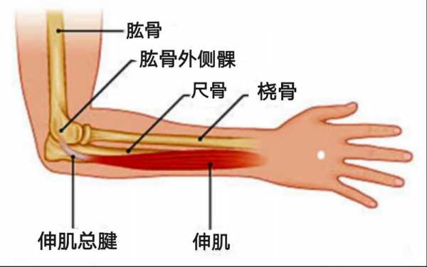 胳膊肘关节疼痛叫什么病