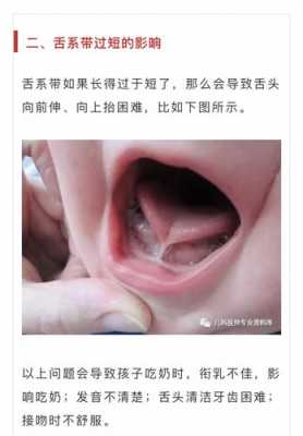 舌系带短的宝宝有什么影响