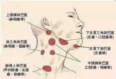 为什么会有淋巴结结节 为什么会有淋巴结