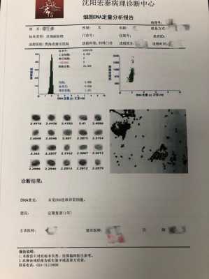 dna细胞定量分析检查是什么意思-dna定量细胞学检查是什么