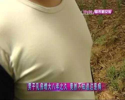 男孩乳房大是什么原因