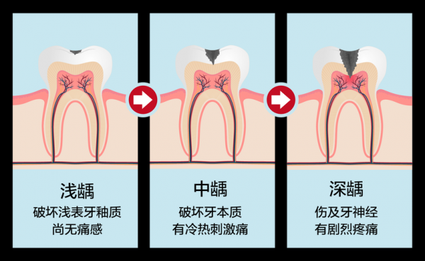 牙齿开裂是什么原因造成的