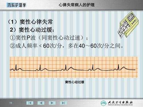 什么是窦性心律不齐的症状及危害 什么是窦性心律不齐