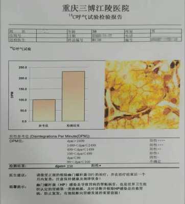 hp阳性是什么意思,c14呼气试验hp阳性是什么意思 