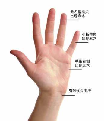 右手中指和无名指麻木是什么原因引起的怎么办-右手中指和无名指麻木是什么原因