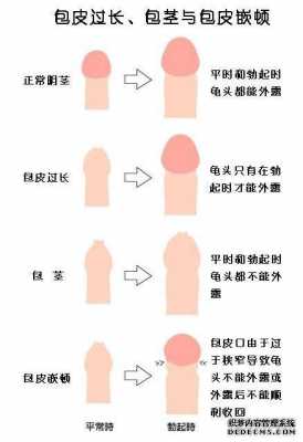 包皮什么样_男性包皮什么样