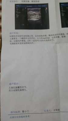 乳腺囊实性结节是什么意思,乳腺囊实性结节是什么意思2类 