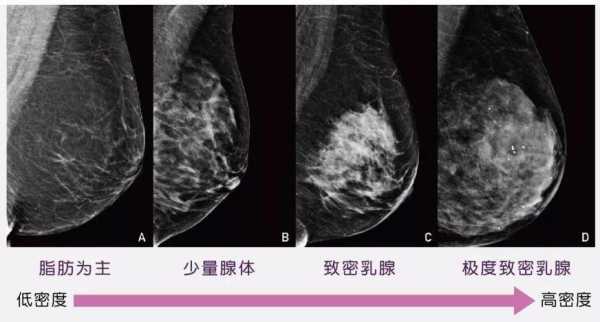 体型是什么意思,双乳腺呈多腺体型是什么意思 