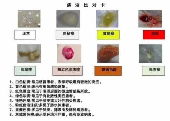 做痰培养都能查出什么疾病-做痰培养都能查出什么