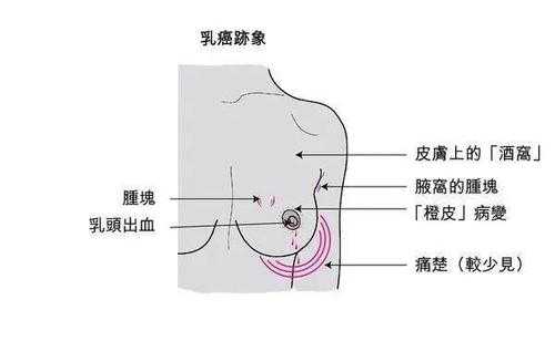 排卵后胸疼是什么原因_排卵后胸疼是什么原因引起的