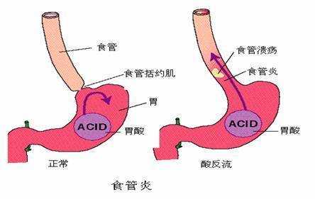 胃的作用和功能是什么（胃的作用和功能是什么百度百科）