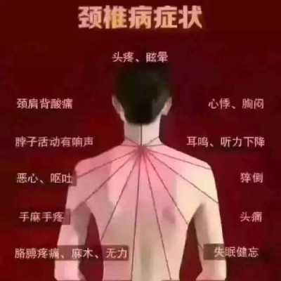 颈椎病是什么症状,颈椎病是什么症状给我解释一下 