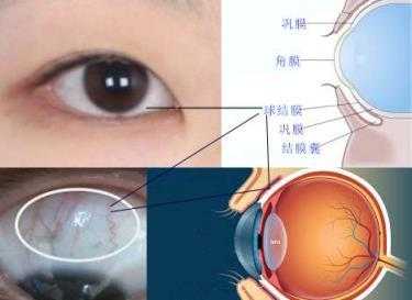  白眼球是什么膜「白眼球是什么膜黑眼球是什么膜」