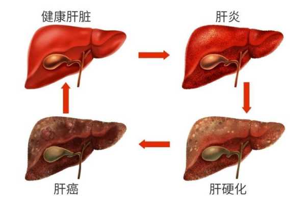 肝损伤是怎么回事什么是肝损伤,肝损伤能自愈吗 