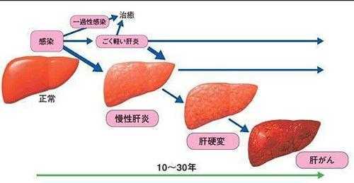 肝损伤是怎么回事什么是肝损伤,肝损伤能自愈吗 