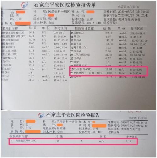 类风湿因子正常值是多少 类风湿因子是什么意思