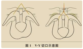 男人的那个东西怎么称呼-男人的生殖器叫什么