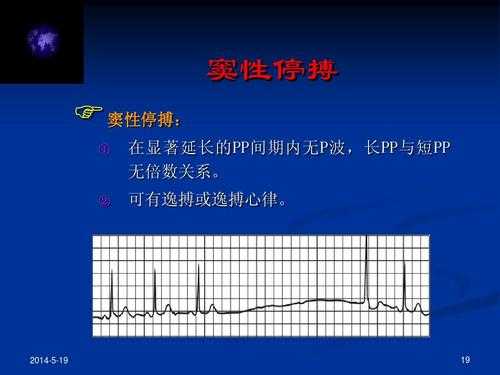 停搏的意思是什么-停博是什么意思