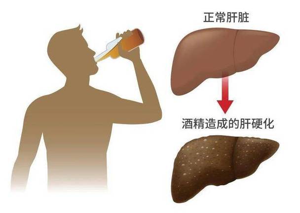 喝酒后吃什么养胃护肝_解酒护肝十大排行榜