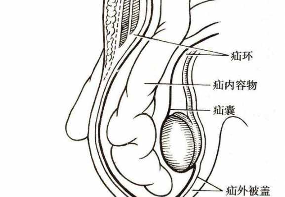 看阴囊挂什么科（阴囊看什么科室最好）