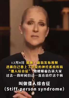 僵人综合征是什么病（僵人综合症的前期症状）