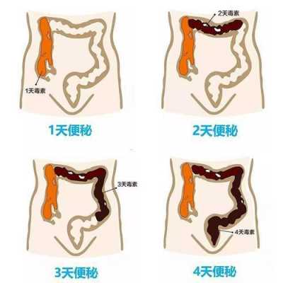 肠干是什么原因造成的,老是便秘是什么原因引起的呢 