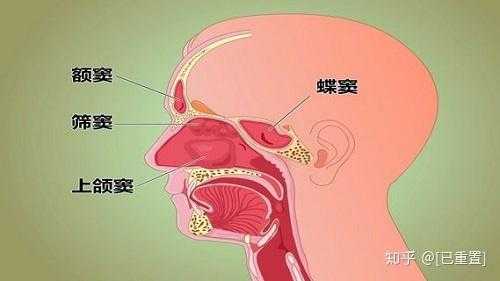 右侧上颌窦炎是什么病