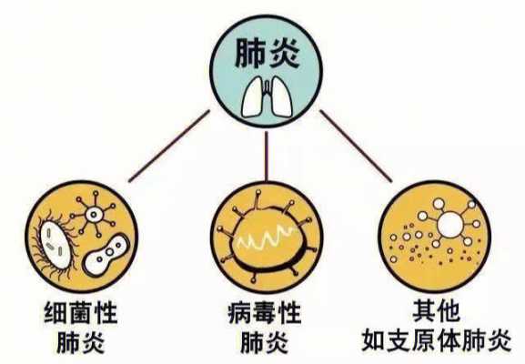 肺炎是什么引起的