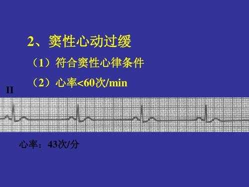 脉缓是什么意思_脉搏过缓是什么原因造成的