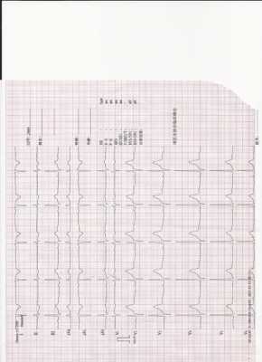 心电图主要查什么病_心电图查什么病?